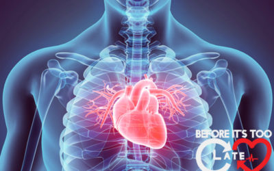 What is Heart Disease?